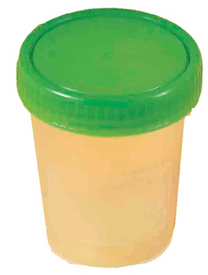 URINBECHER mit Schraubdeckel