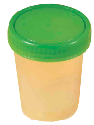 URINBECHER mit Schraubdeckel - 1St - Urinbecher, Urin- & Stuhltests