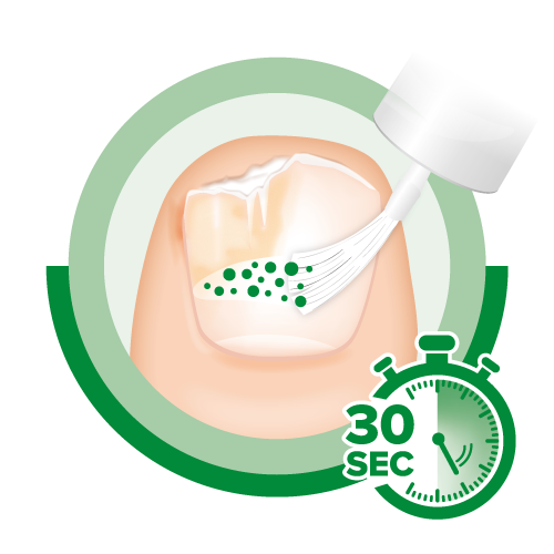 Einfache Anwendung von Ciclopoli®.