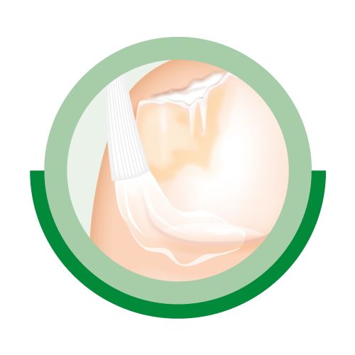 Auftragen von Ciclopoli® Nagellack.