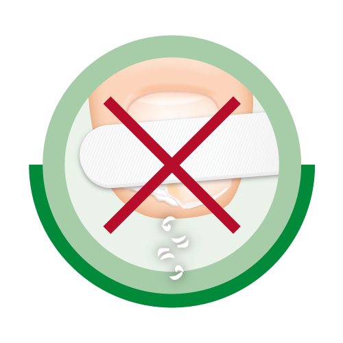 Die Anwendung von Ciclopoli® funktioniert ohne Feilen.