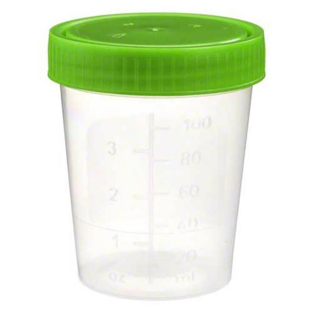 URINBECHER mit Schraubdeckel - 1St - Urinbecher, Urin- & Stuhltests