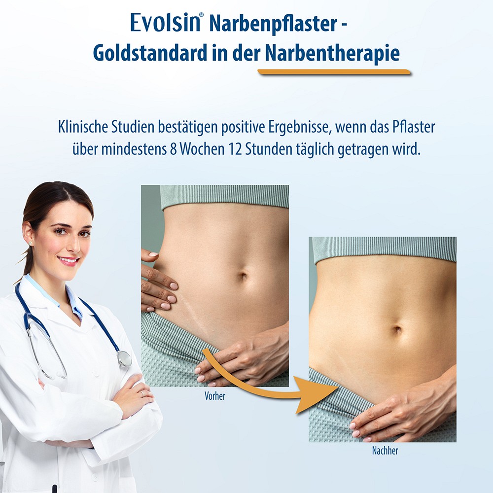 EVOLSIN Narbenpflaster 2x200 cm EVOLSIN Narbenpflaster 2x200 cm