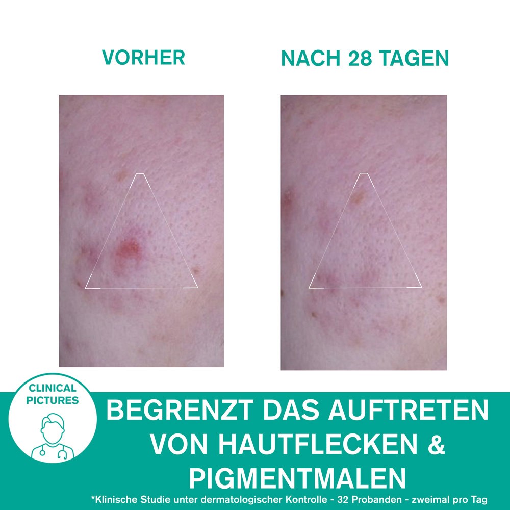 URIAGE Hyseac 3-Regul+ global-Pflegecreme