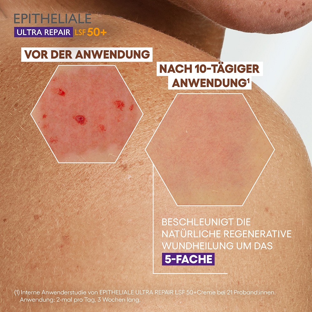 A-DERMA EPITHELIALE ULTRA Repair Creme LSF 50+