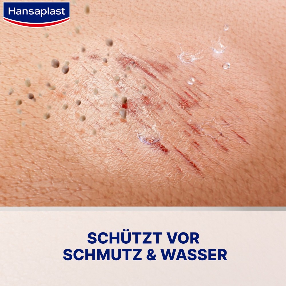 HANSAPLAST Zweite Haut Schutz Sprüh-Pflaster