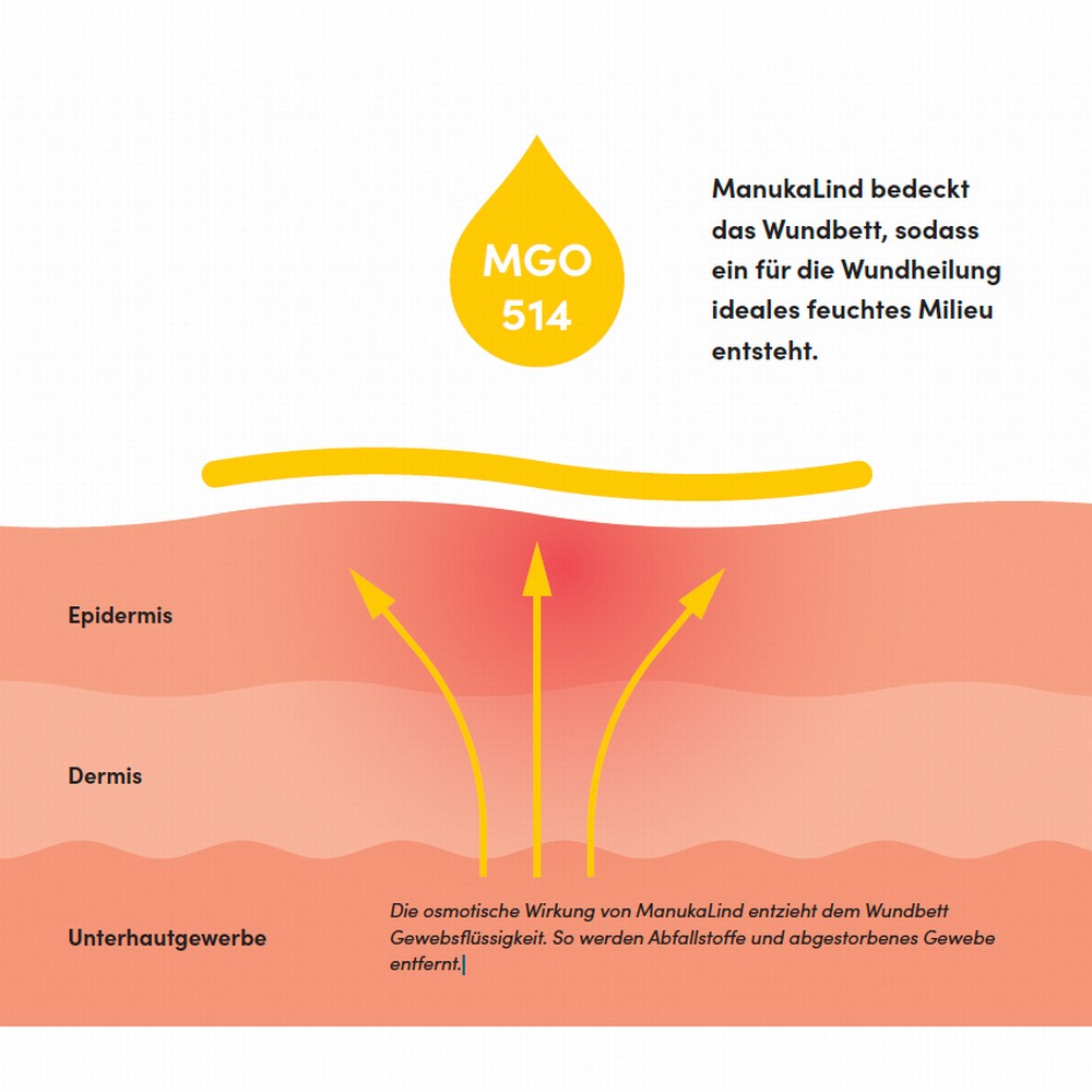 MANUKALIND Wundheilsalbe MDD